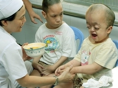 Exhortan ayuda a víctimas vietnamitas del agente naranja/dioxina